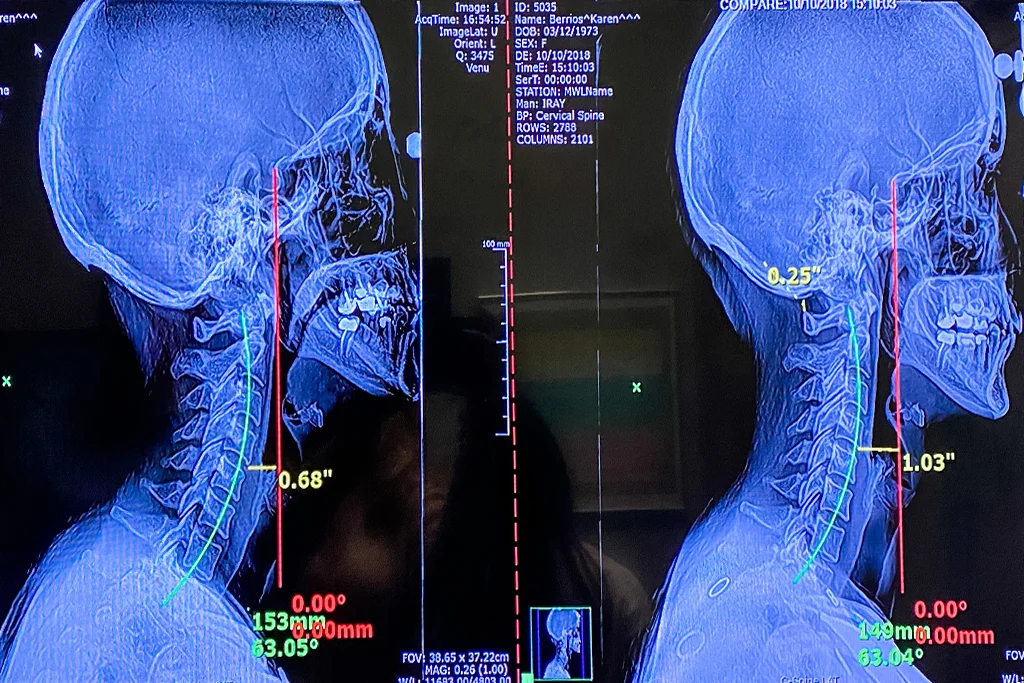 Neck Pain Springfield Missouri