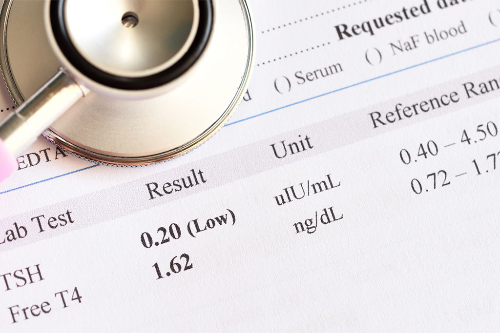 Reading thyroid test results can be daunting and overwhelming, especially if you’re told to wait for your doctor to review them. During that waiting time, you’re most likely anxiously heading to Google and typing in each line you see on your papers.